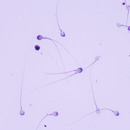Biologický mikroskop MAGUS Bio 260T