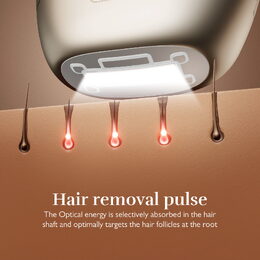 Silk'n pulzní laserový epilátor Silk’n 7 Champagne s flexibilní hlavou (600