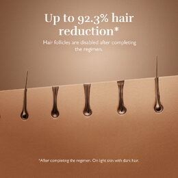 Silk'n pulzní laserový epilátor Silk’n 7 Champagne s flexibilní hlavou (600