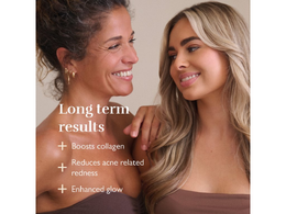 Silk'n LED profesionální obličejová maska