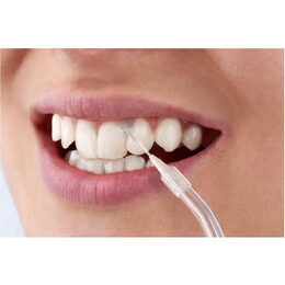 SOI 1310BL Ústní sprcha SENCOR