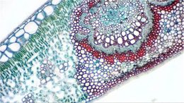 Bresser MikrOkular Full HD Eyepiece Digital Camera